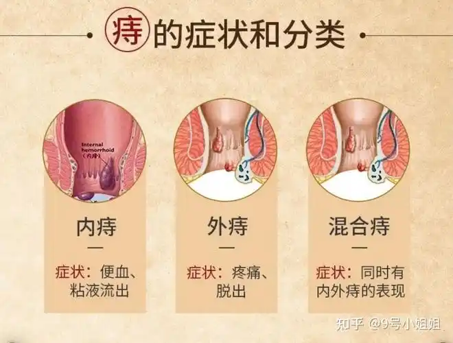 痔疮出血怎么治疗方法