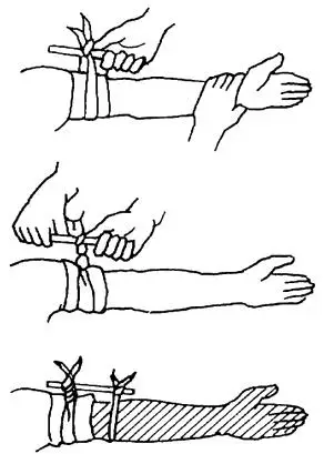 止血包扎静脉输血氧气吸入护理专业技术实训