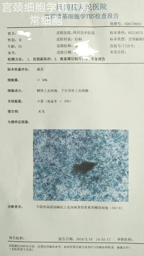 宫颈tct及dna倍体异常结果