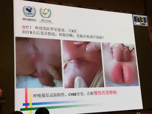 性皮肤病           1,湿疹/特应性皮炎(ad)            2,尿布皮炎