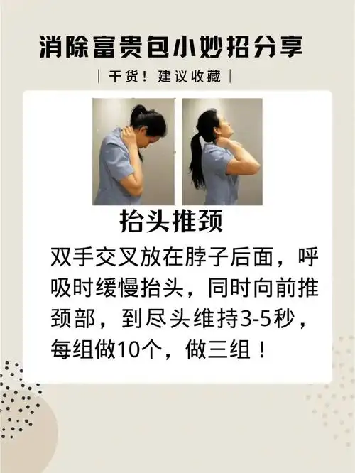 富贵包是夺命包366个动作帮你消除它