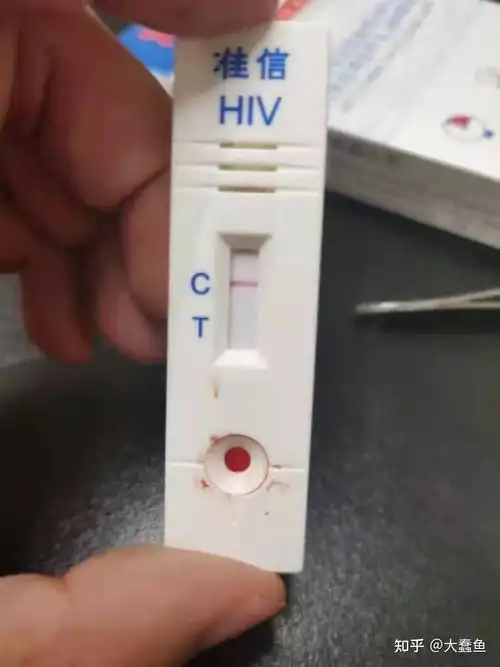 hiv试纸显示阴性一定是正常的吗