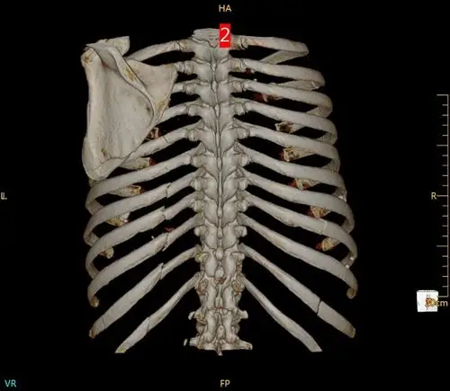 通辽市中医院 ct 科新开展检查项目及病例展示.