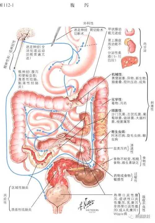奈特图谱丨小肠解剖及相关疾病