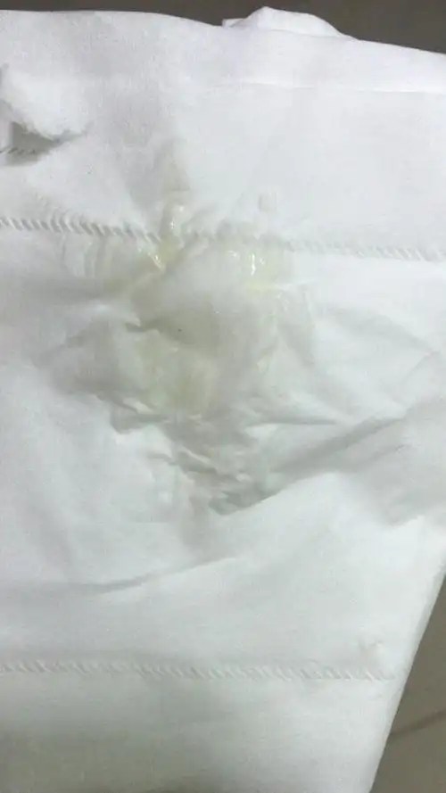 白带黄绿色求救