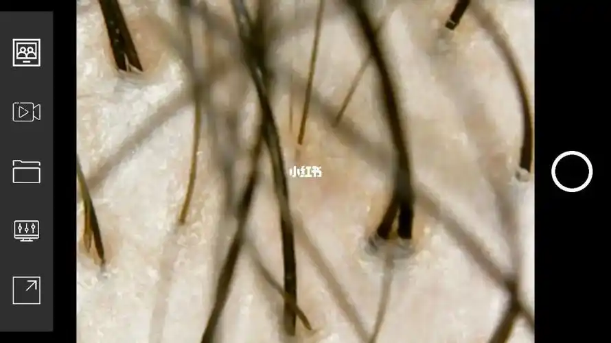 请问有人认识那个毛囊旁边小小的是头发吗  机器放大500倍看到的   不