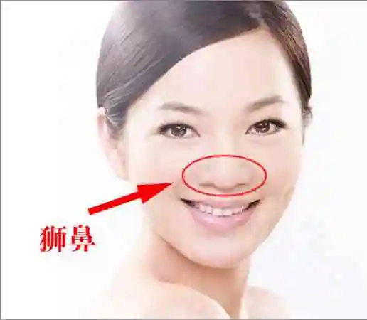 都有"这根线" 这种鼻子鼻梁平直, 其次是鼻翼较大能旺夫