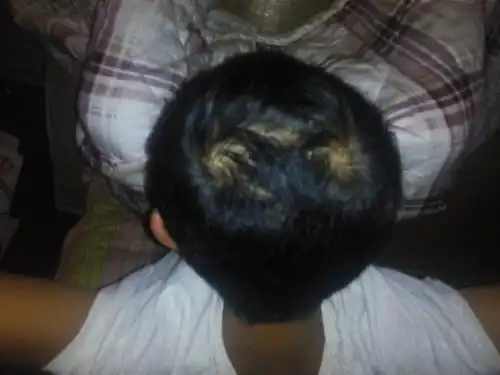 娃头顶"2个旋"说明倔?常见的头旋误区家长要了解,不是迷信