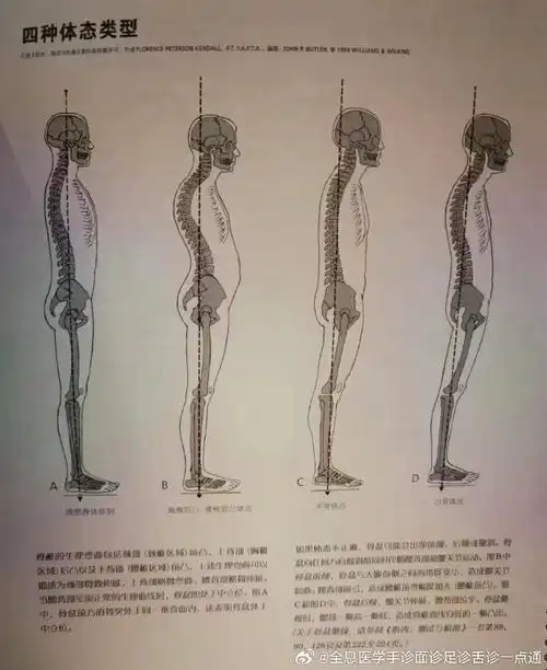 四种常见体态脊椎的生理曲度包括颈部(颈椎区域)前凸,上背部(胸椎区域