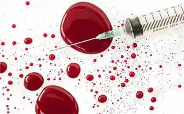 熊猫血是什么血型熊猫血有什么特征