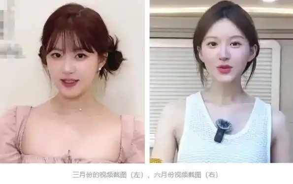 赵露思近照美爆全网,她到底是瘦了还是整容了?