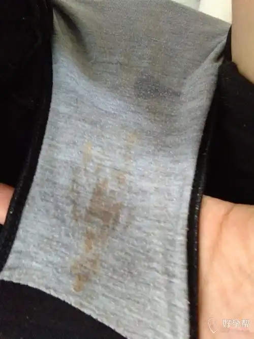 是月经有问题还是怎么样