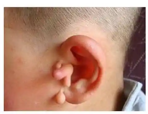 耳朵栓马桩的意义