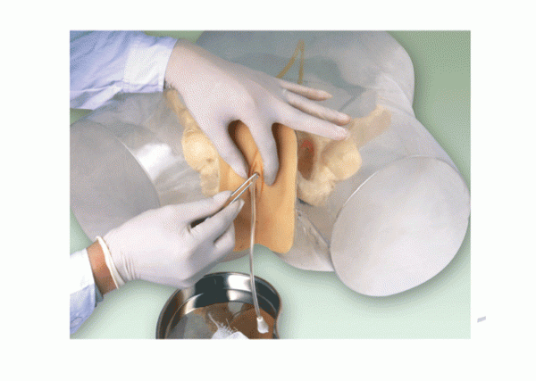 高级透明女性导尿模型医学模型