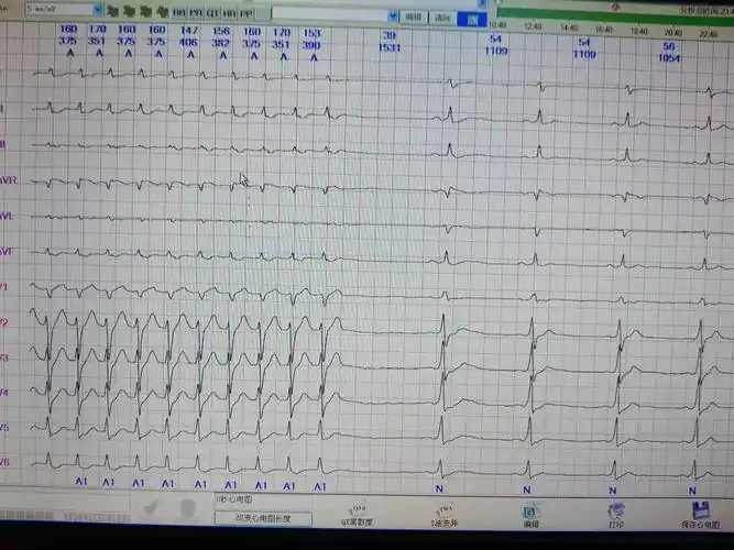 怀孕33 4做心电图心率过快 (第2页)