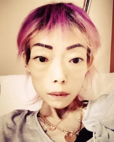 可是如今的伍智恒瘦得皮包骨,脸颊凹陷,身上没有一丝肉,状如骷髅