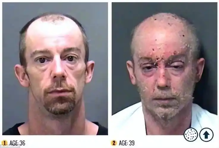 触目惊心!这才是吸毒前后真实的面容变化_毒品_生命_网友