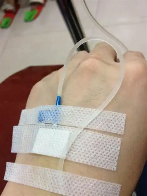 打吊瓶图片手部图片打吊瓶图片真实图片2022已更新今日动态