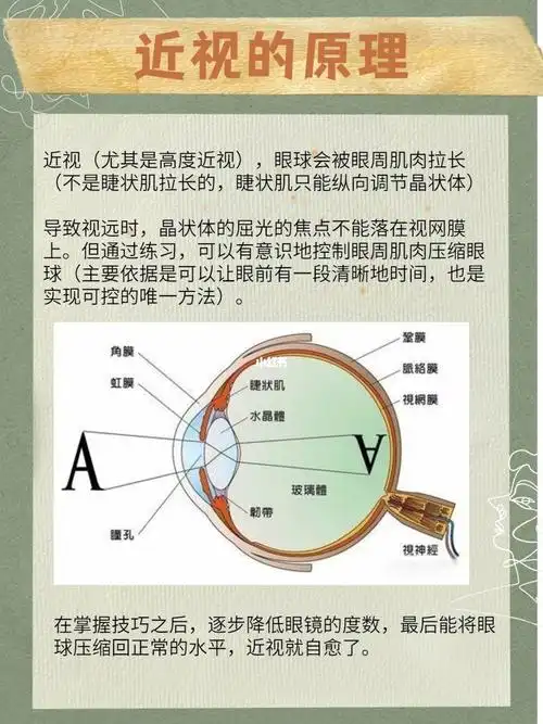 总结近视的原理以及训练的做法,800以下进_近视_工作_医疗健康_医疗