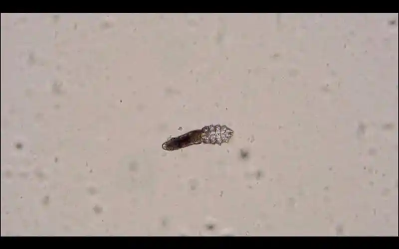显微镜下放大1000倍的螨虫