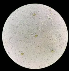 蛔虫卵用显微镜在大便中发现灵芝卵.照片