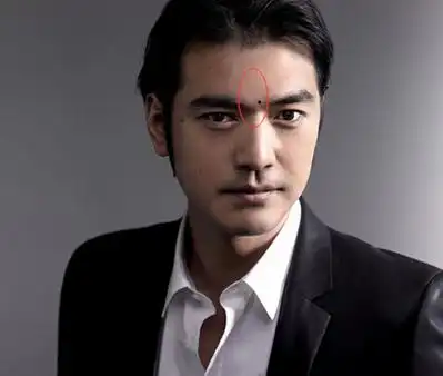 4,颧骨代表掌权,颧骨有痣的话管理方面可能出错,生意上碰到麻烦事