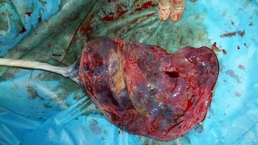 产科图片,收集了几张,留着以后慢慢回忆!