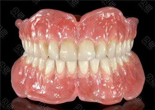 全口吸附性义齿