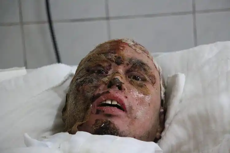 泪目:丈夫烧伤躺医院,孕妻即将生产急哭_人民号