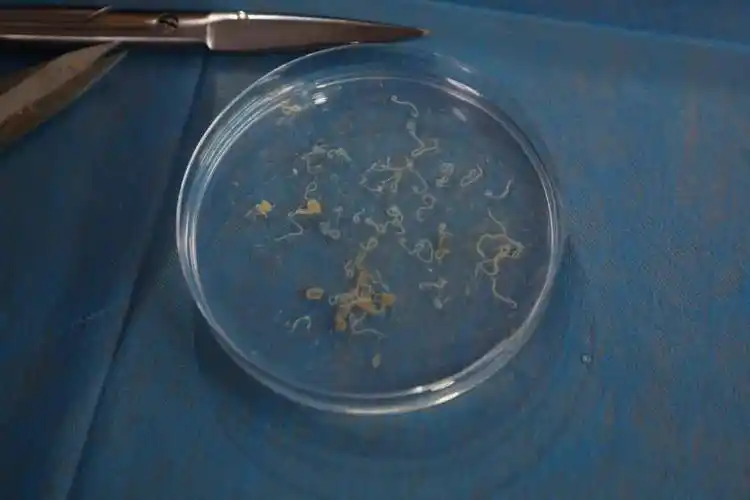 异尖线虫其中小黄鱼和青占鱼感染率较高都检测出了异尖线虫其余四类鱼