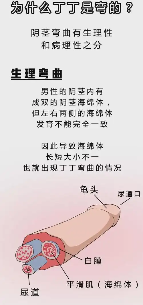 男性丁丁健康养护要点,告诉你为什么有些人是弯的|骨折|海绵体|硬块