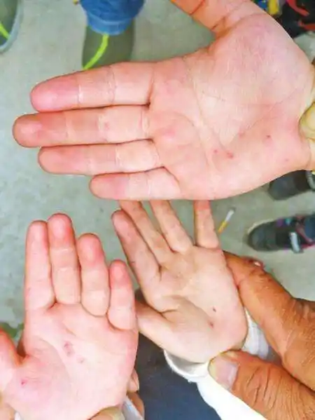 河南针扎幼儿老师被拘老师应严惩不贷