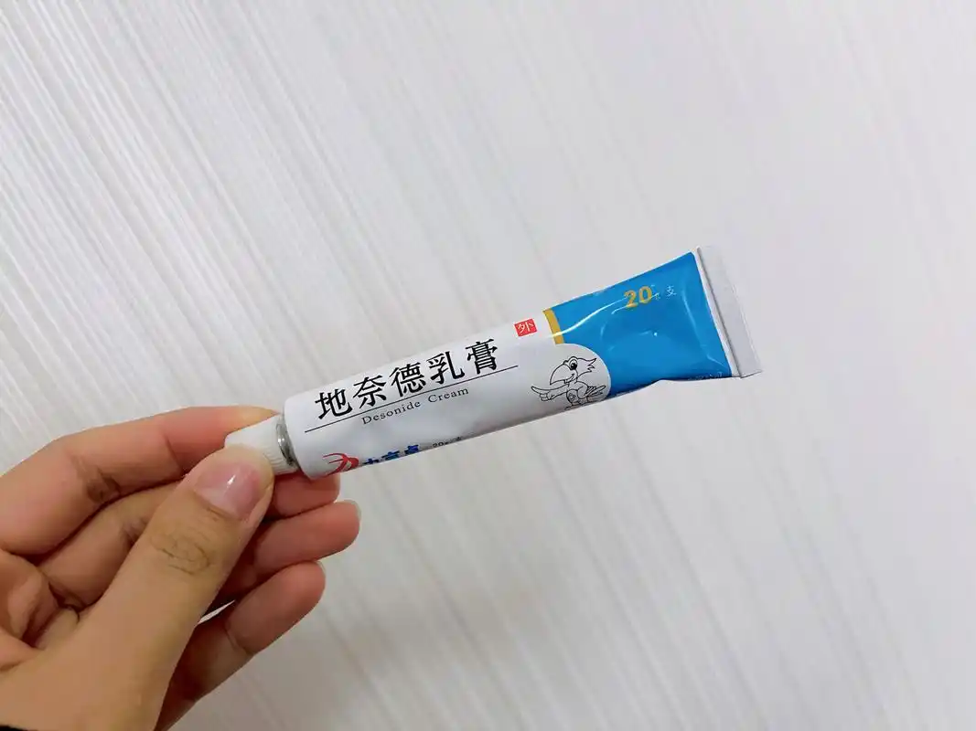 湿疹宝宝必备好用无激素药膏 地奈德乳膏 90参考价:0-10元/20g,可以