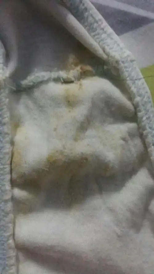 请问内裤上这一堆脏乎乎的东西,是有阴道炎了吗?