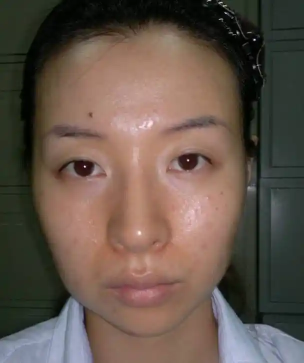 李素荣:油性皮肤这种去油的方法是真的还是假的?