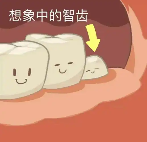 #想象中和实际中的智齿##春日cityhappy计划#