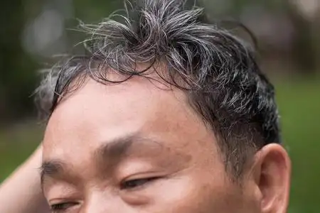 白发老头老高, 中级岁满头白发的问题照片