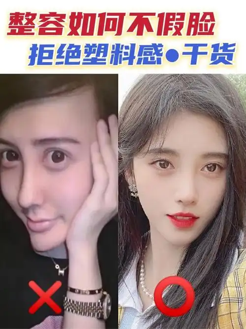 do脸必看|整容不假脸7515全攻略鹤鹤最近看到一个小_圈子-新氧