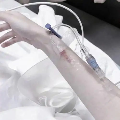 女生输液好看手背照片头像超清病床上的女生漂亮手背吊针图片头