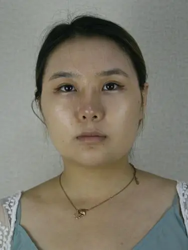 你有一份最新瘦脸秘籍待查收以前我的脸很宽大,颧骨突出,下颌角宽大