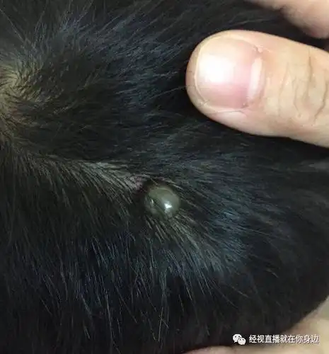 武汉7岁男孩头顶突然出现"黑痣",还越长越大,医生一检查竟发现是……_