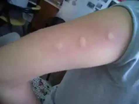 九成人不知道蚊子的天敌是啥房间放个它一整夜开窗都不怕