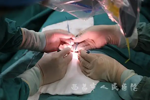 西昌市人民医院完成首例显微镜下精索静脉曲张高位结扎术