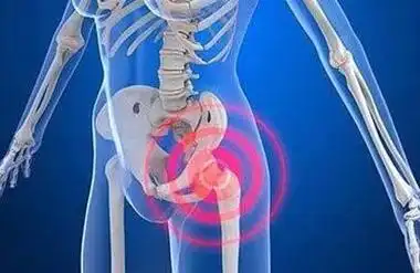 胯骨痛,走路久了痛,坐久了也痛,这到底是怎么了?