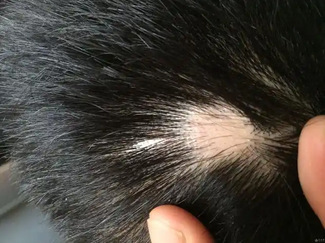 麻烦帮我看看掉头发