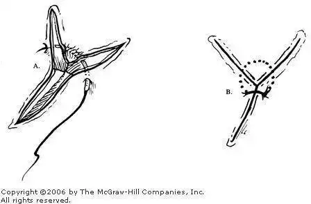 中国三棱军刺有剧毒,造成的伤口难以缝合遭国际禁用?别扯了!