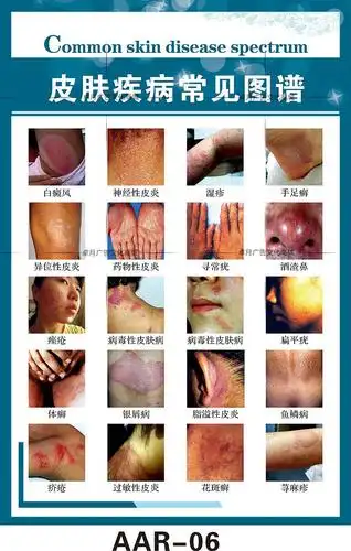 皮肤病墙贴纸皮肤疾病常见图谱贴纸医院皮肤科挂图宣传装饰画海报