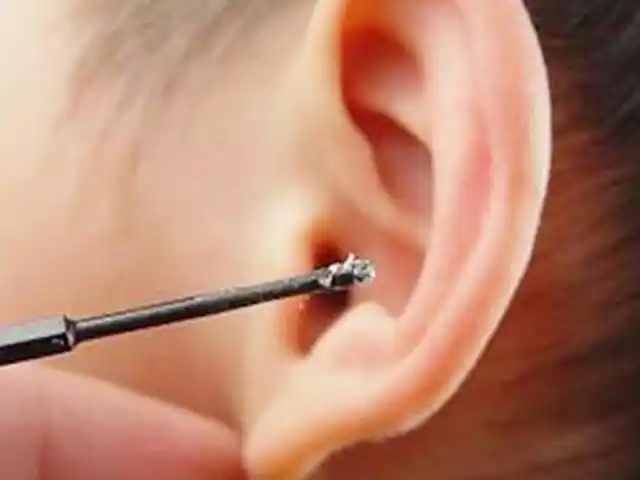 耳垢"垃圾"?关于耳朵的小秘密你知道哪些?