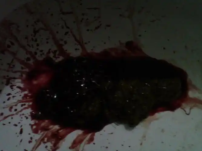 大约五天前也曾肚子疼想大便,但是无大便而是便鲜血.请问是肠癌吗?