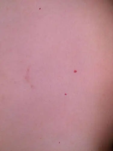 胸前这几个红点点是什么东西,好多年了